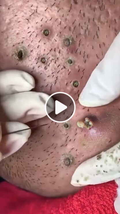 The Jewel of the Nile